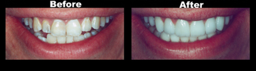 Case_2